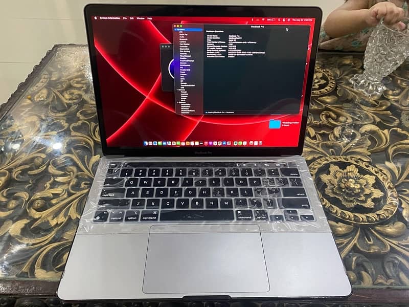 **MacBook Pro 2020 with M1 Chip: Revolutionary Speed and Efficiency*